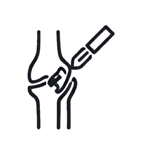 Minimally Invasive TKR